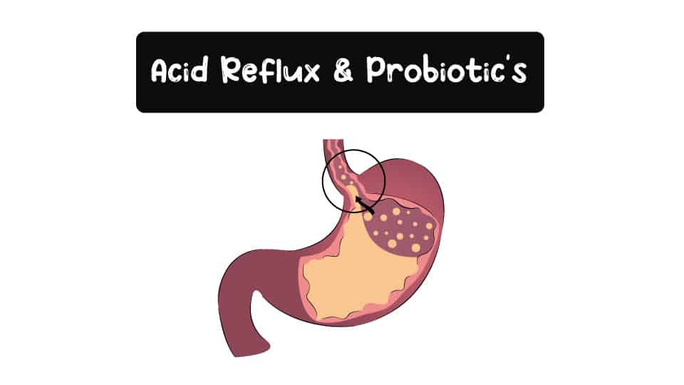 Acid_Reflux_And_Probiotic_Thumbnail