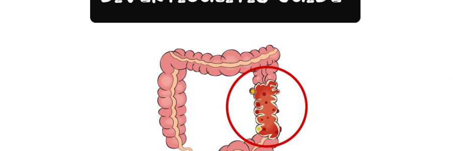 Diverticulitis-Probiotic-Thumbnail