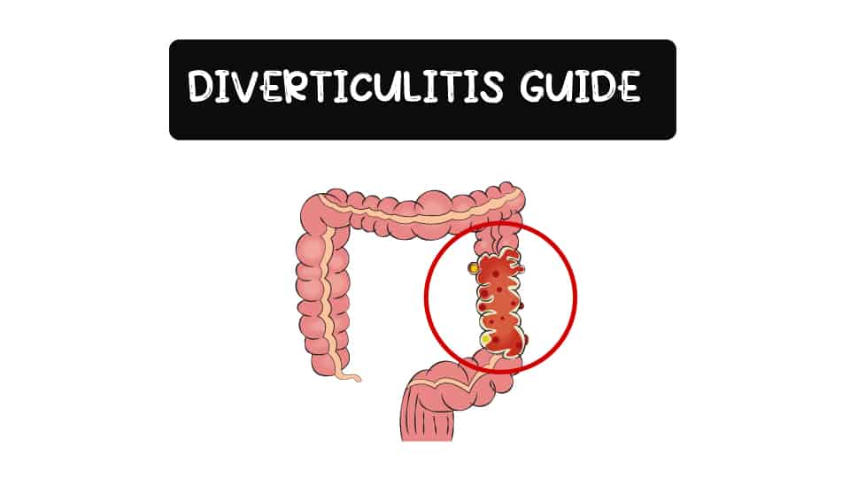 Diverticulitis-Probiotic-Thumbnail