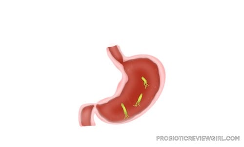 H.Pylori-Diagram