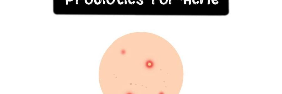 Probiotic-For-Acne-Thumbnail