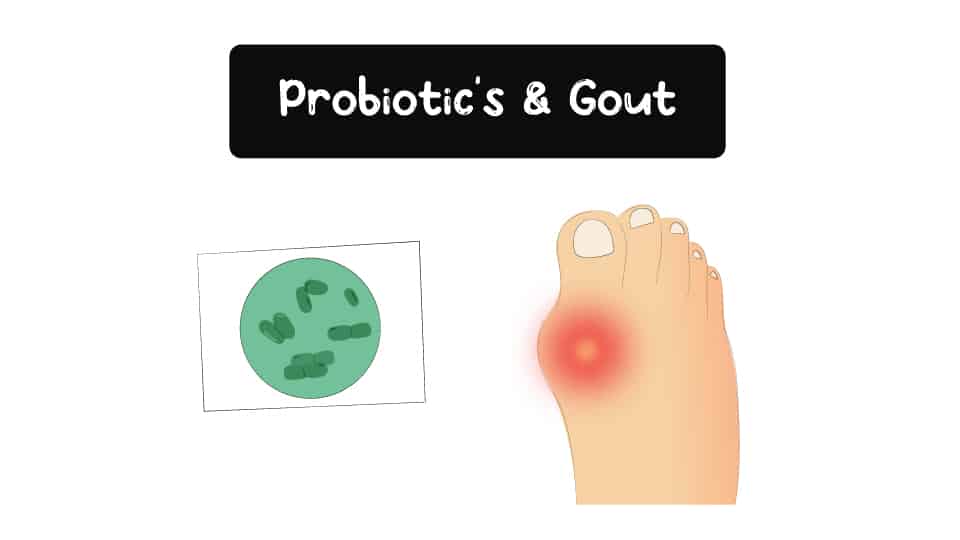 Probiotics-And-Gout-Thumbnail