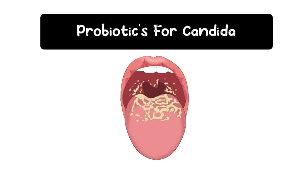 Probiotics-For-Candida-Thumbnail