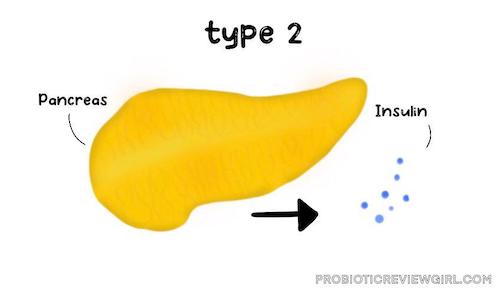 Type-2-Diabetes