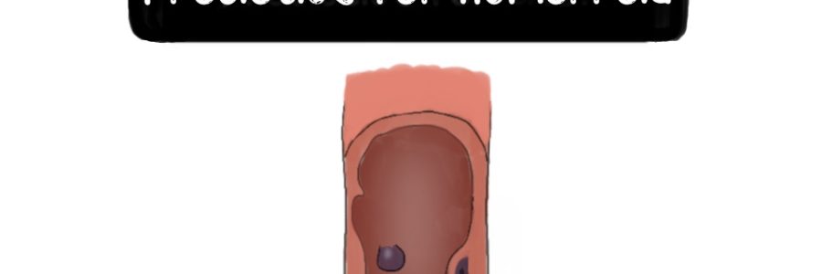 hemorrhoid-thumbnail