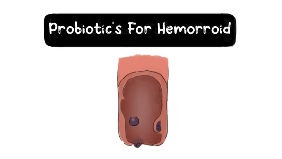 hemorrhoid-thumbnail